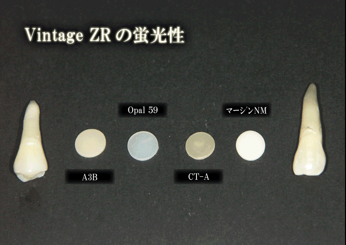 ジルコニア用陶材「ヴィンテージZR」登場！