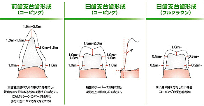 【裁断済】支台歯形成の面基準