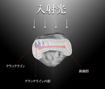クラックライン模式図