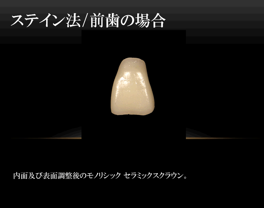 前歯ステイン動画解説付き.gif