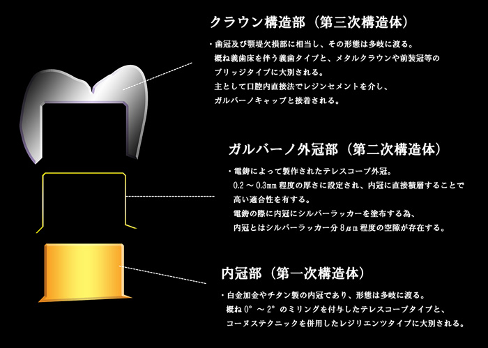 図03_ドッペル図解.jpg